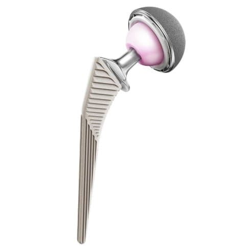 Photographie d'un implant de prothèse totale de hanche : tige fémorale, tête et cupule